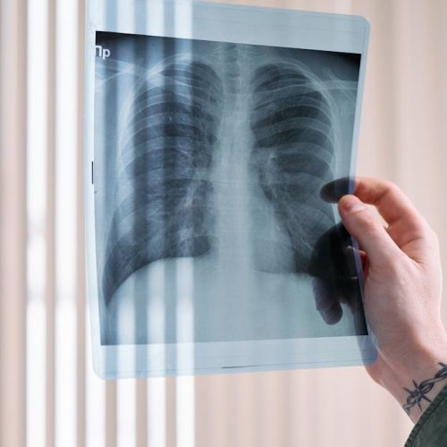 Exacerbations in COPD and Role of Tobacco Smoking, Clinical Indicators, and Medication Management​​